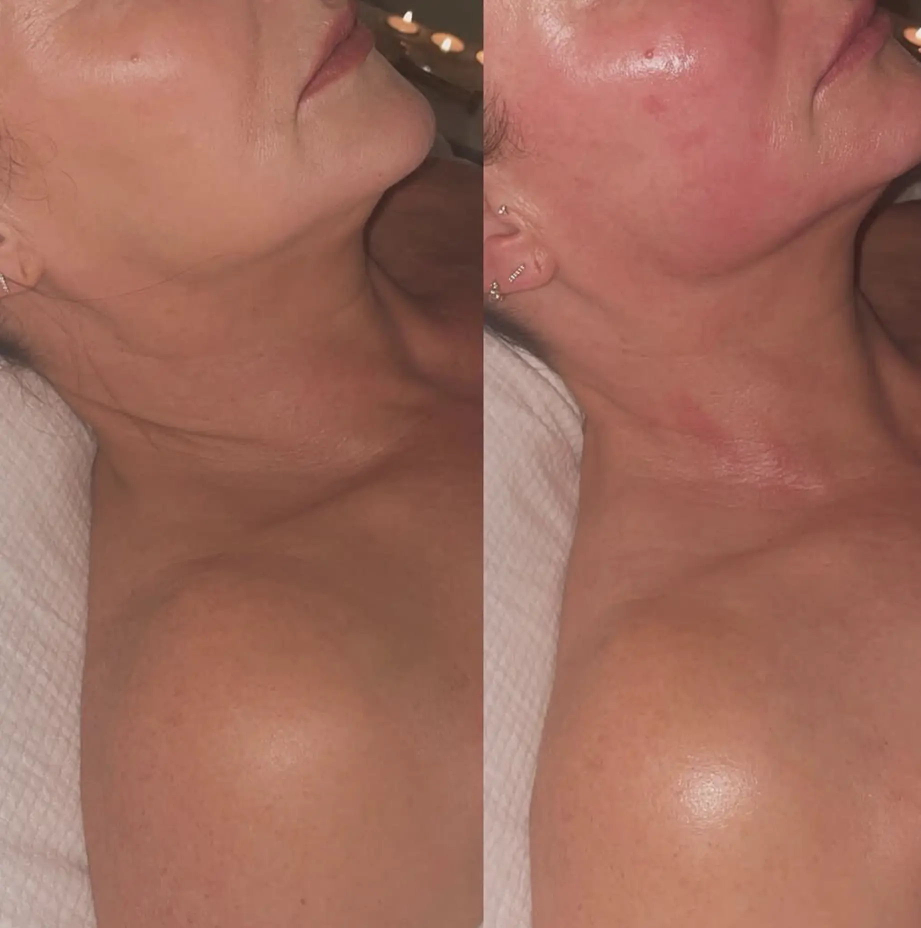 buccal massage training