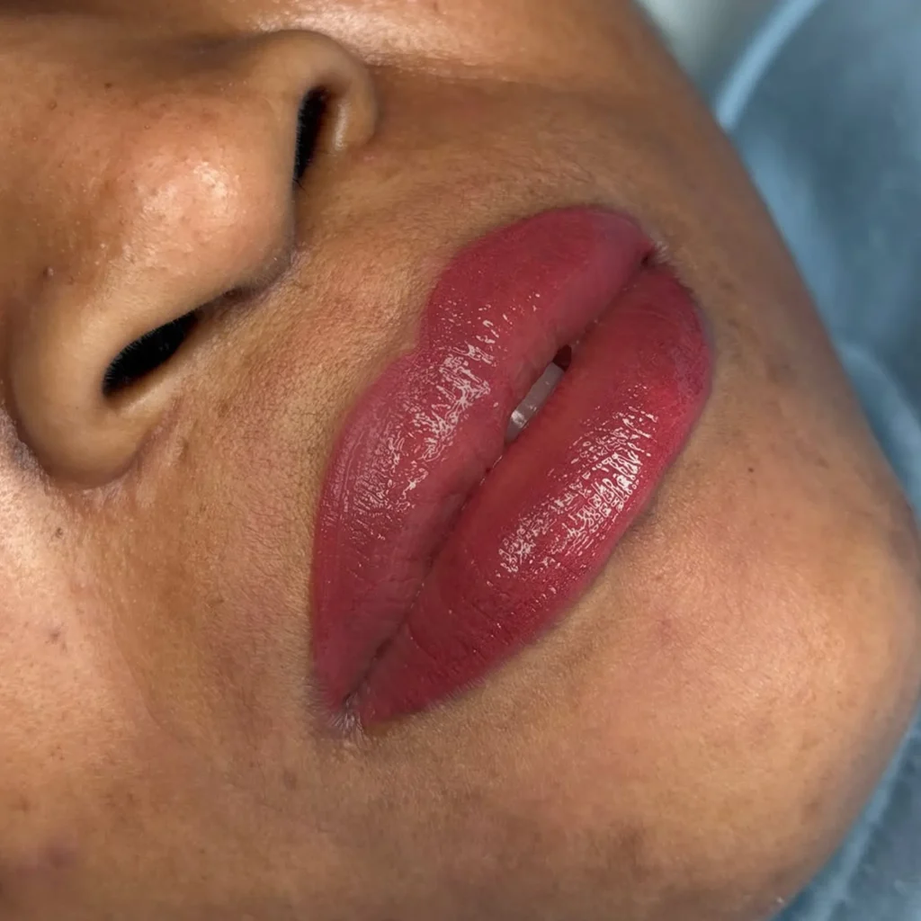 before and after dark lip neutralisation