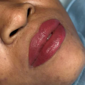 before and after dark lip neutralisation